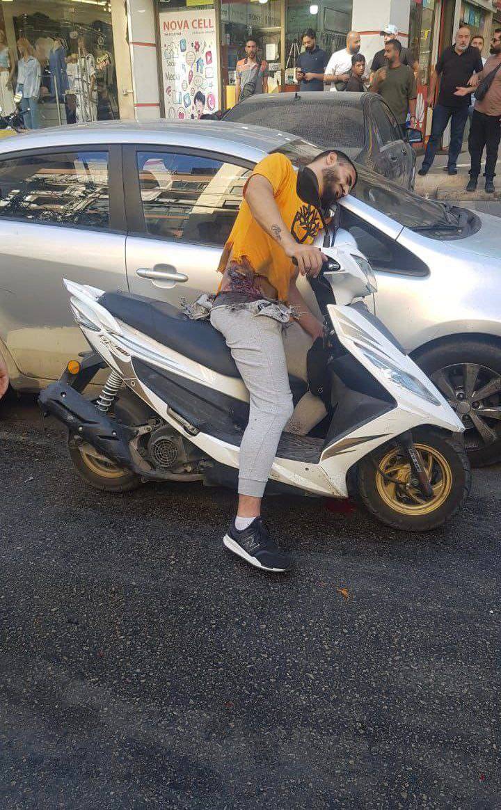  Ранен от взривил се пейджър 